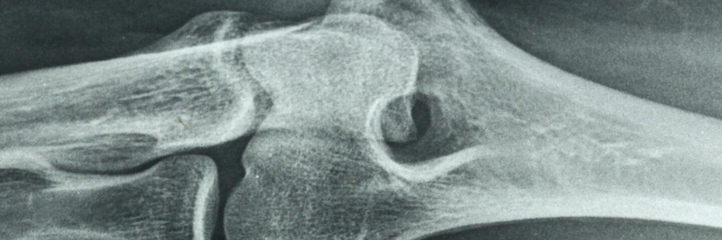 osteoimmunology-bone-and-immune-interactions-and-related-pathologies-orl-biox401