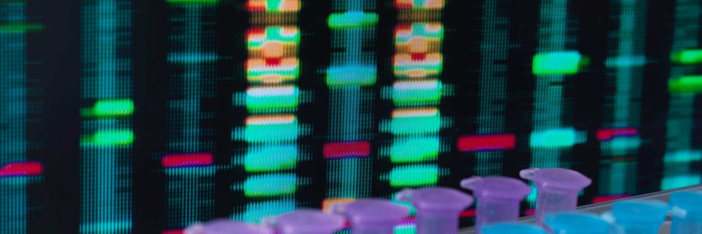 DNA Research, DNA test results on a computer screen in the laboratory with a tray of samples in the foreground